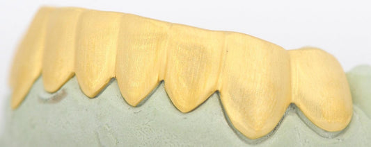 JDTK-S161706-1A 6 Teeth Sand Finish - Johnny Dang & Co