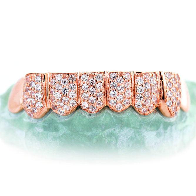 8 TEETH 6 WITH DIAMONDSHONEYCOMB PRONG SETTING - Johnny Dang & Co