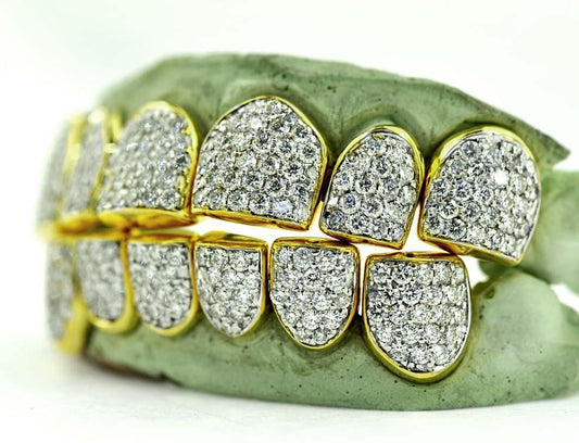 JDTK-G16-CHANDELIER - SI/VS/VVS Diamond Special Hand Prong Set Permanent Diamond Cap - Johnny Dang & Co