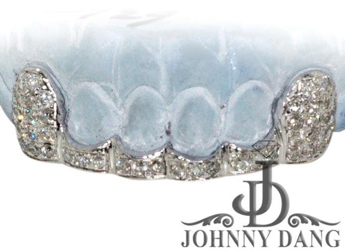 JDTK-G20 Beyonce's Hand Prong Set Diamond Grill - Johnny Dang & Co
