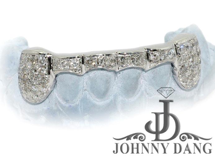 JDTK-G20 Beyonce's Hand Prong Set Diamond Grill - Johnny Dang & Co