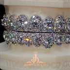 JDWR-2026-38-A GIA "Honeymoon" Set Grillz White Gold (Pull Out)