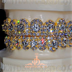 JDWR-2026-39 NO GIA "Honeymoon" Set Grillz Yellow Gold (Pull Out)