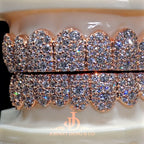 JDWR-2026-28 Flawless Mosaic Set Grillz Rose Gold (Pull Out)