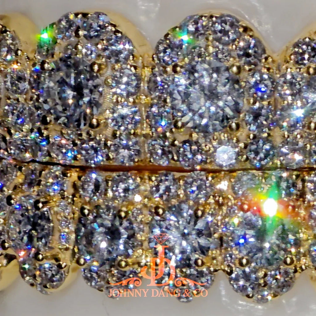 JDWR-2026-39 NO GIA "Honeymoon" Set Grillz Yellow Gold (Pull Out)