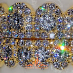 JDWR-2026-39 NO GIA "Honeymoon" Set Grillz Yellow Gold (Pull Out)