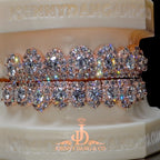 JDWR-2026-35 NO GIA "Honeymoon" Set Grillz Rose Gold (Pull Out)