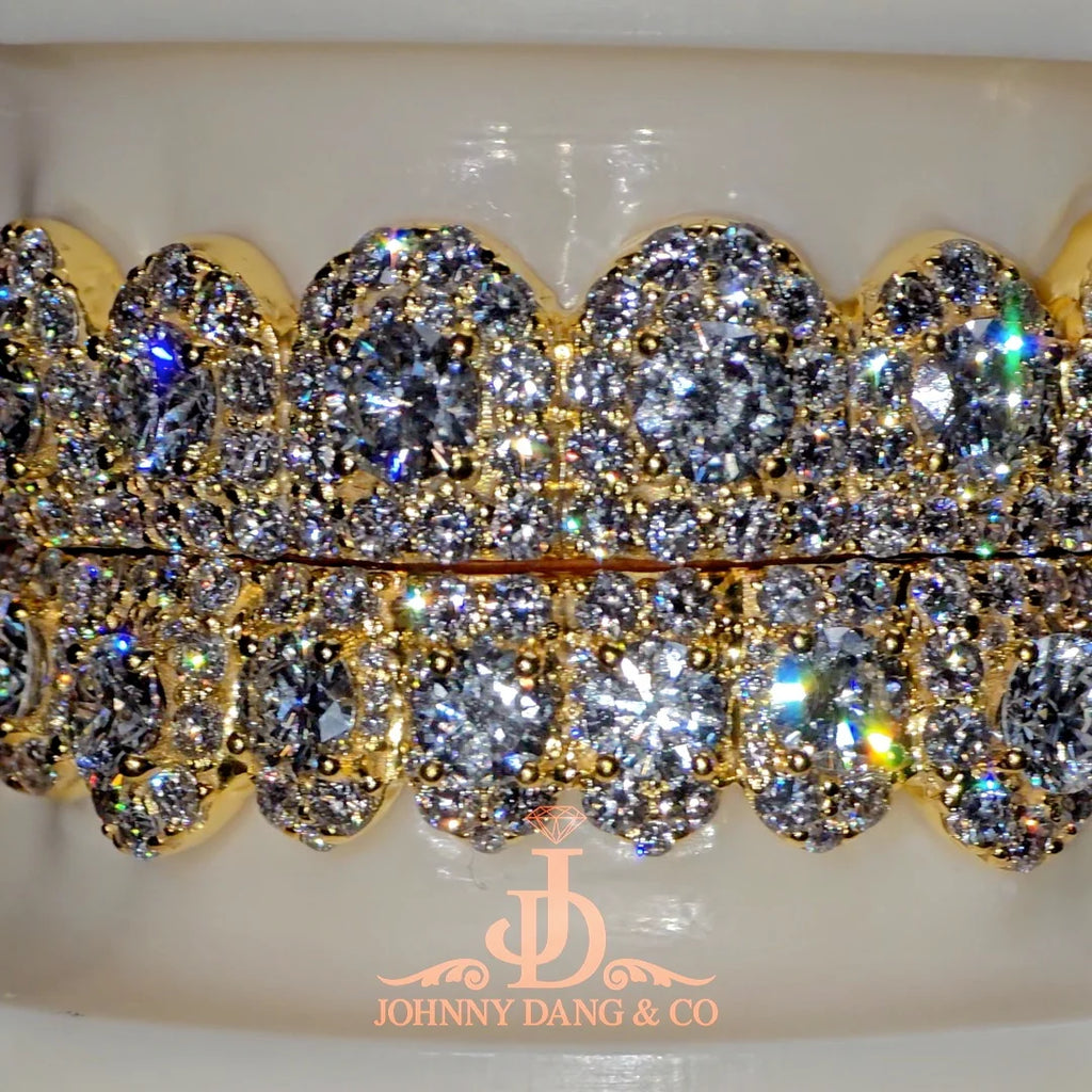 JDWR-2026-39 NO GIA "Honeymoon" Set Grillz Yellow Gold (Pull Out)