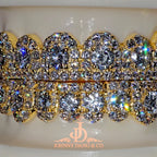 JDWR-2026-39 NO GIA "Honeymoon" Set Grillz Yellow Gold (Pull Out)