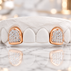 JDWR-0047-2 PRONG SET CUSTOM COLOR DIAMOND TEETH