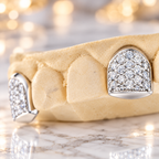 JDWR-0047-2 PRONG SET CUSTOM COLOR DIAMOND TEETH