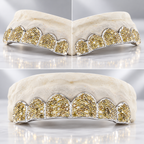 JDWR-C108C YELLOW DIAMOND HAND PRONG SET GRILL