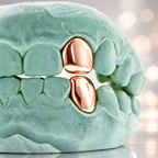 JDWR-S151506-1 SINGLE 18K INDIVIDUAL PERMANENT Cap / Tooth