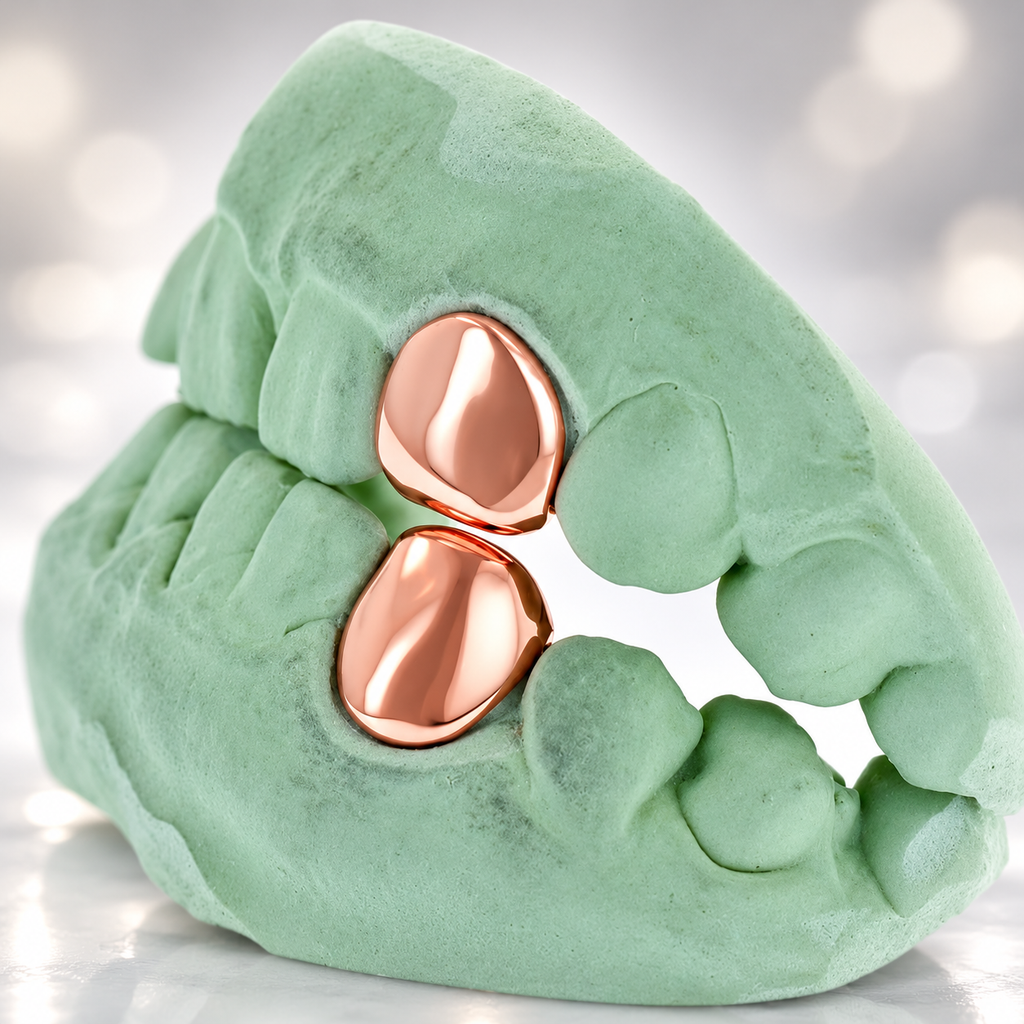 JDWR-S151506-1 SINGLE 18K INDIVIDUAL PERMANENT Cap / Tooth