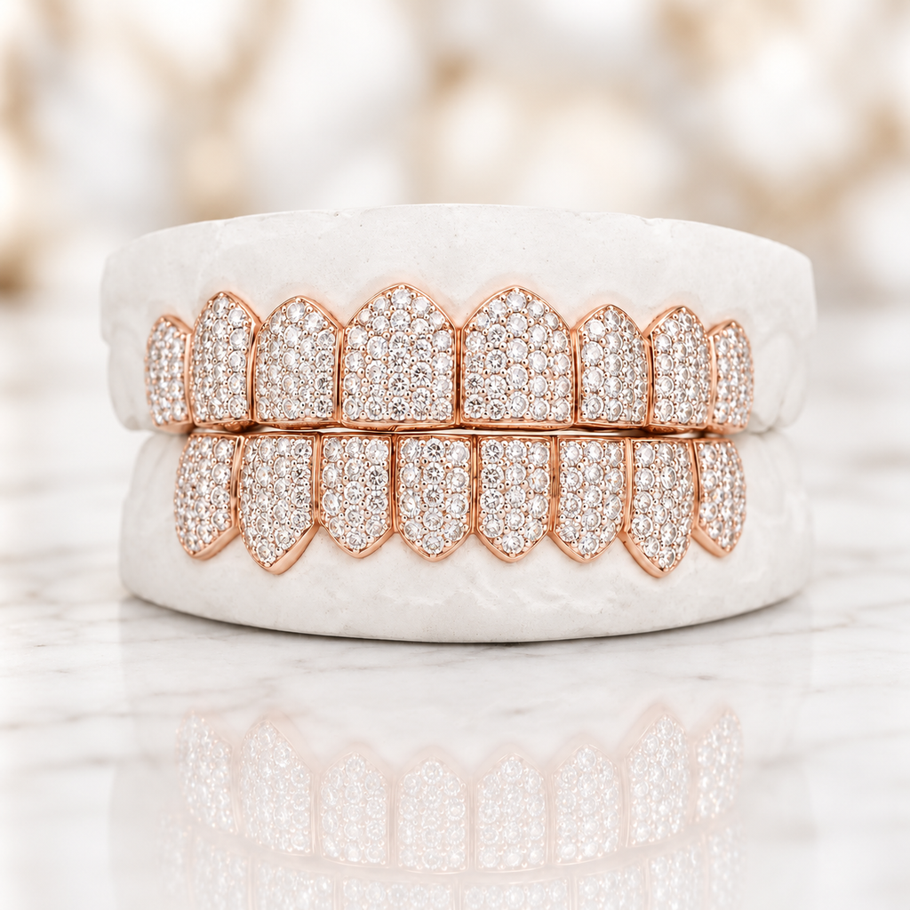 JDWR-7420-GMoney Bagg Yo's SI Diamond Grill