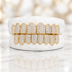 JDWR-7420-GMoney Bagg Yo's SI Diamond Grill