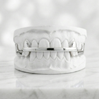 Diamond Bar Grillz Full Back