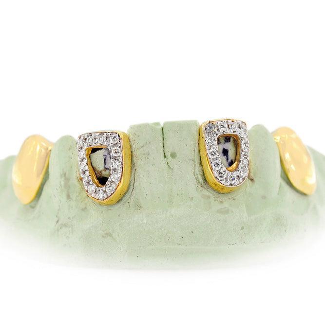 JDG1001- OPEN FACE AND SOLID TEETH PULLOUT GRILLZ - Johnny Dang & Co