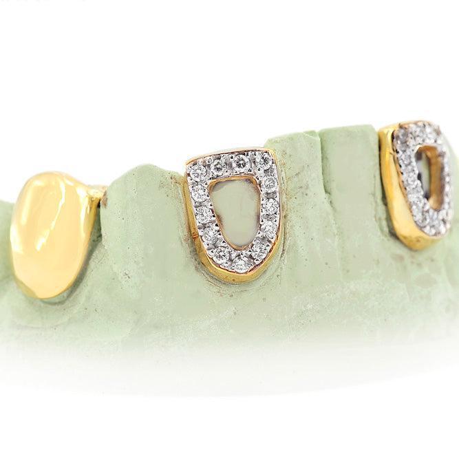 JDG1001- OPEN FACE AND SOLID TEETH PULLOUT GRILLZ - Johnny Dang & Co