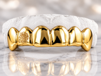 JDWR-ENG15252-2-6 TOP OR 6 BOTTOM Engraved Teeth
