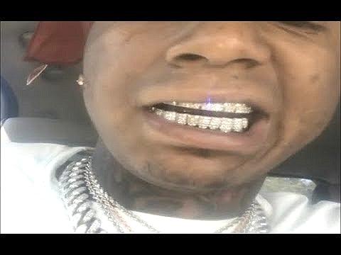 JDTK-GMoney Bagg Yo's SI Diamond Grill - Johnny Dang & Co
