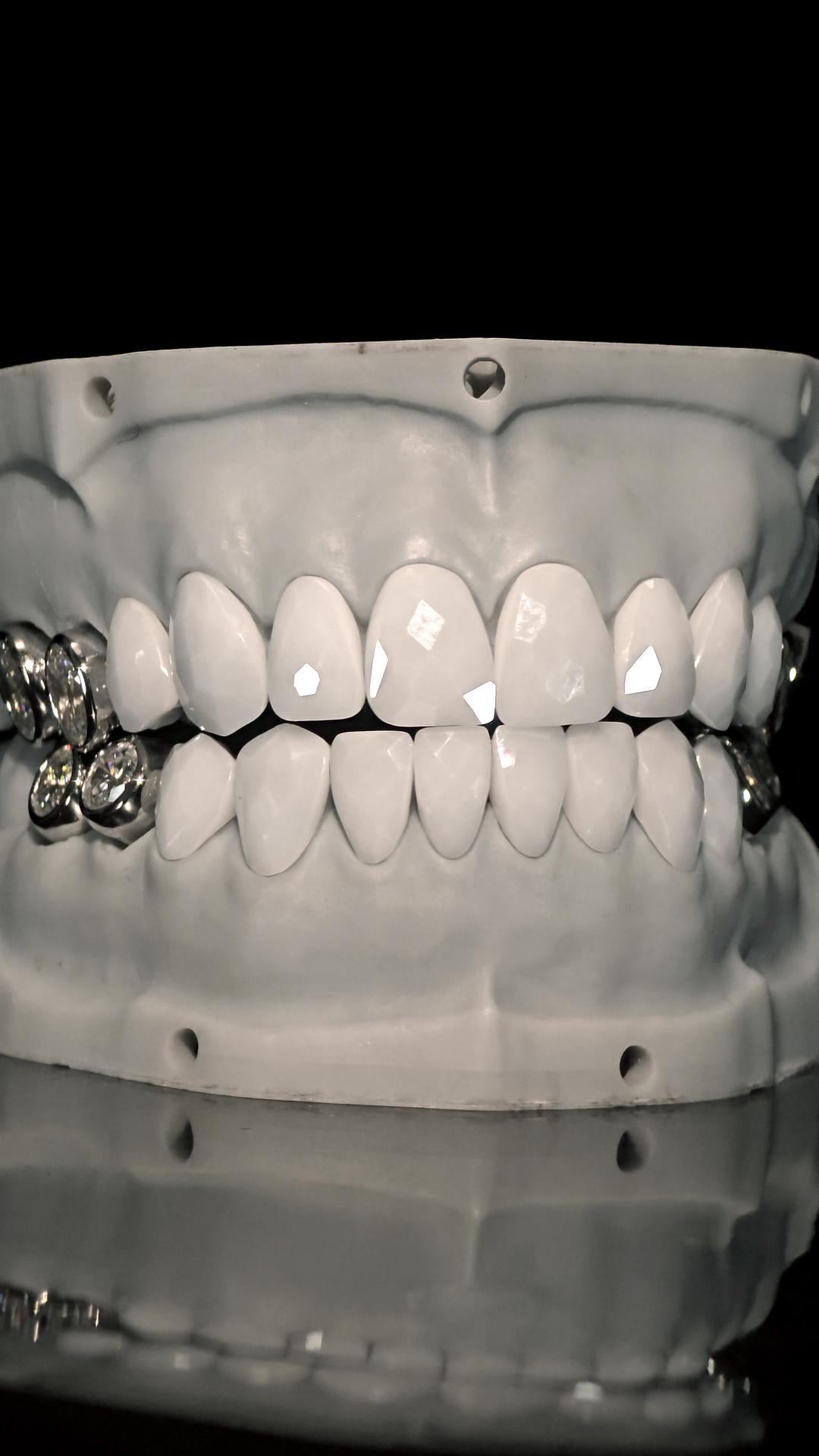 JDWR-V1-CUSTOM-DENTAL-VENEERS