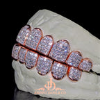 JDWR-2026-7 Flawless "Carre Cut" Invisible Set Grillz Rose Gold (Perm)