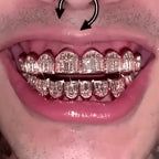Custom Grillz Order - Deposit