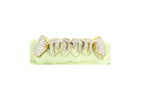 JDTK-2024 - 6 TOP OR 6 BOTTOM SI Hand prong Dripping Diamond Grillz - Johnny Dang & Co
