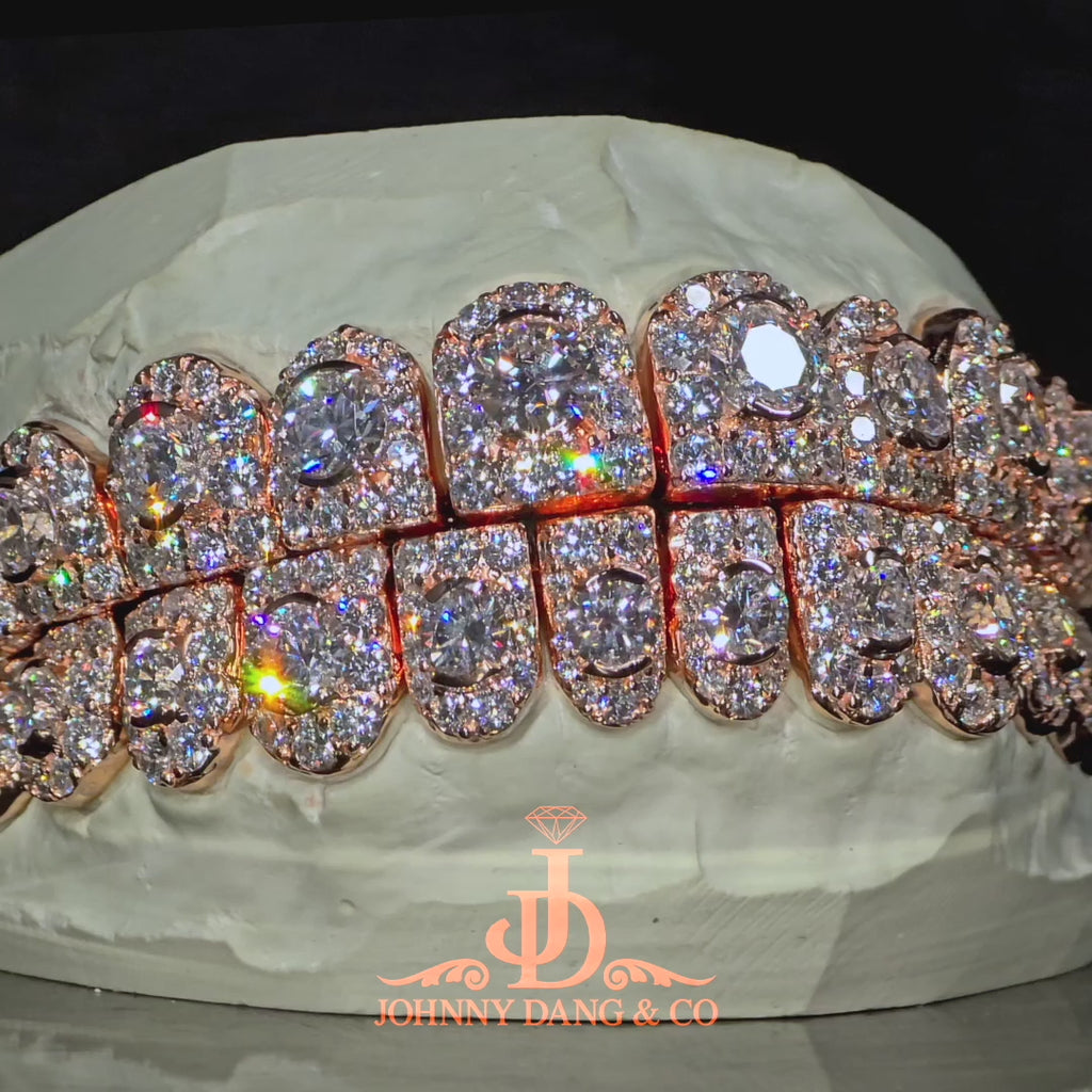 JDWR-2026-34 NO GIA "Honeymoon" Set Grillz Rose Gold (Perms)