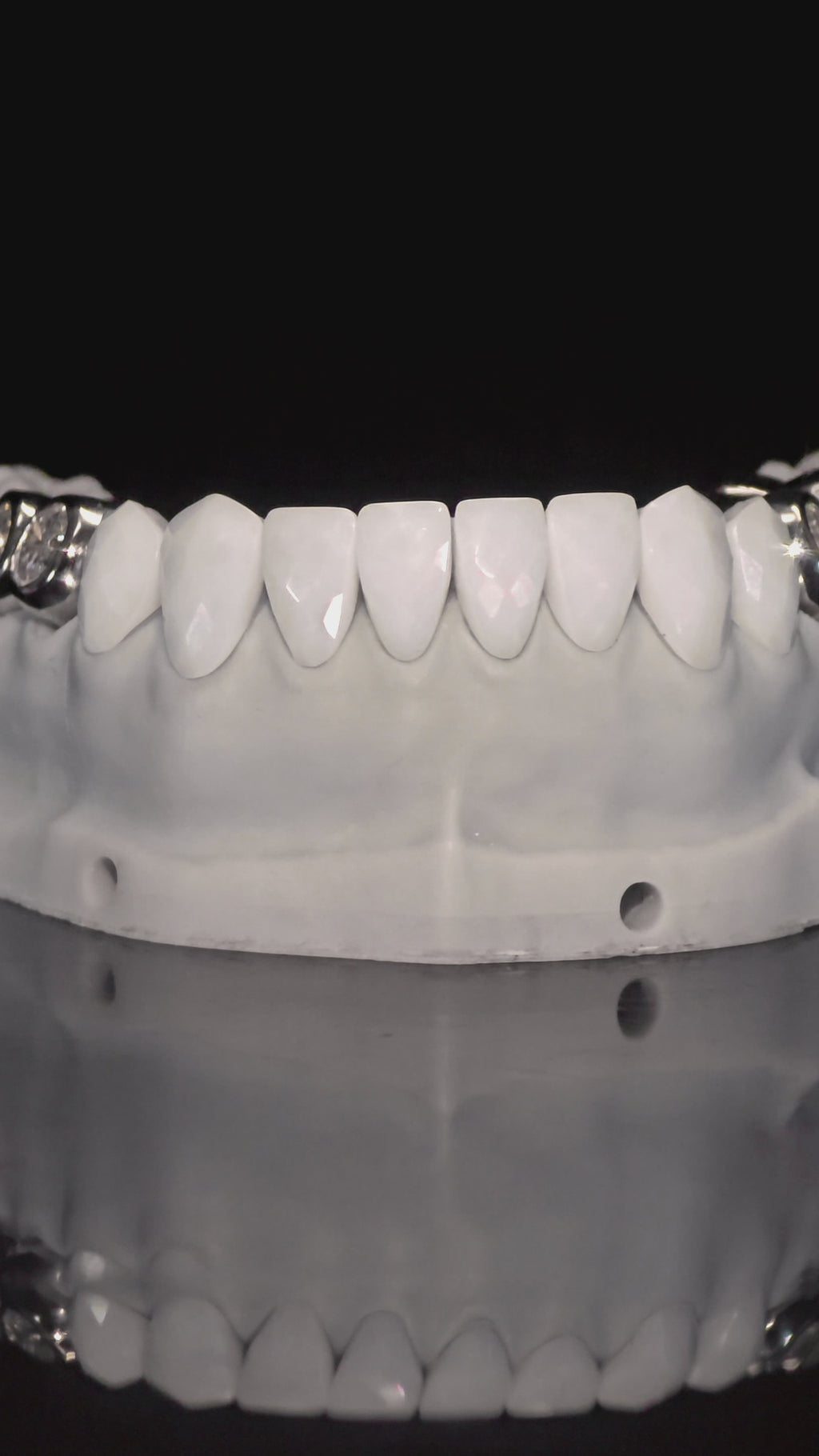 JDWR-V1-CUSTOM-DENTAL-VENEERS