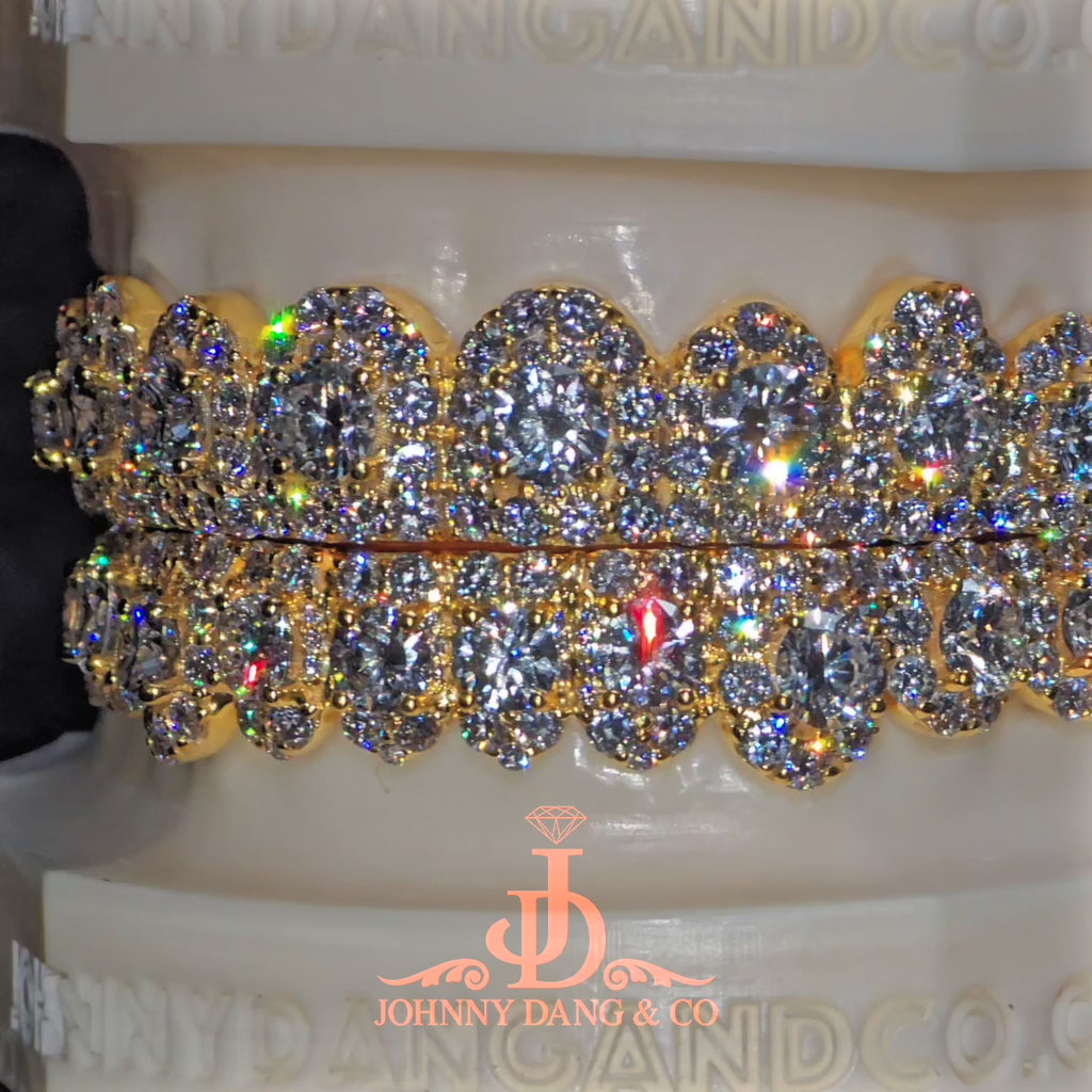 JDWR-2026-39 NO GIA "Honeymoon" Set Grillz Yellow Gold (Pull Out)