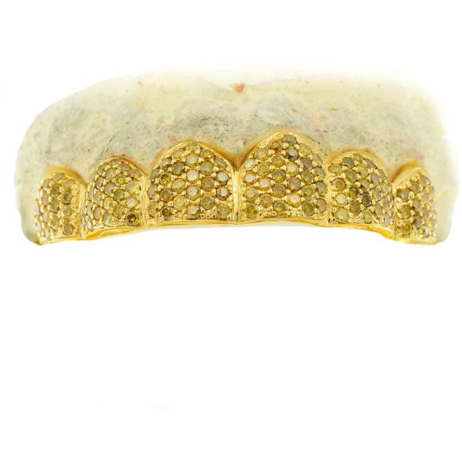 C108C YELLOW DIAMOND HAND PRONG SET GRILL - Johnny Dang & Co