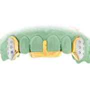 GOLDTEETH TVJ-3011C CUSTOM GOLD AND DIAMOND GRILL - Johnny Dang & Co