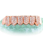 8 TEETH 6 WITH DIAMONDSHONEYCOMB PRONG SETTING - Johnny Dang & Co