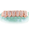 8 TEETH 6 WITH DIAMONDSHONEYCOMB PRONG SETTING - Johnny Dang & Co