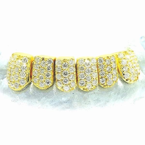 JDTK-S151806-2-NEW -18K Individual Diamond Prong Set Permanent Teeth - Johnny Dang & Co