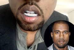 JDTK-S105-KANYE WEST'S CHOICE GRILLZ - Johnny Dang & Co