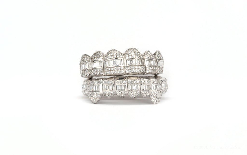 14K VVS Hybrid Diamond Grillz - Johnny Dang & Co