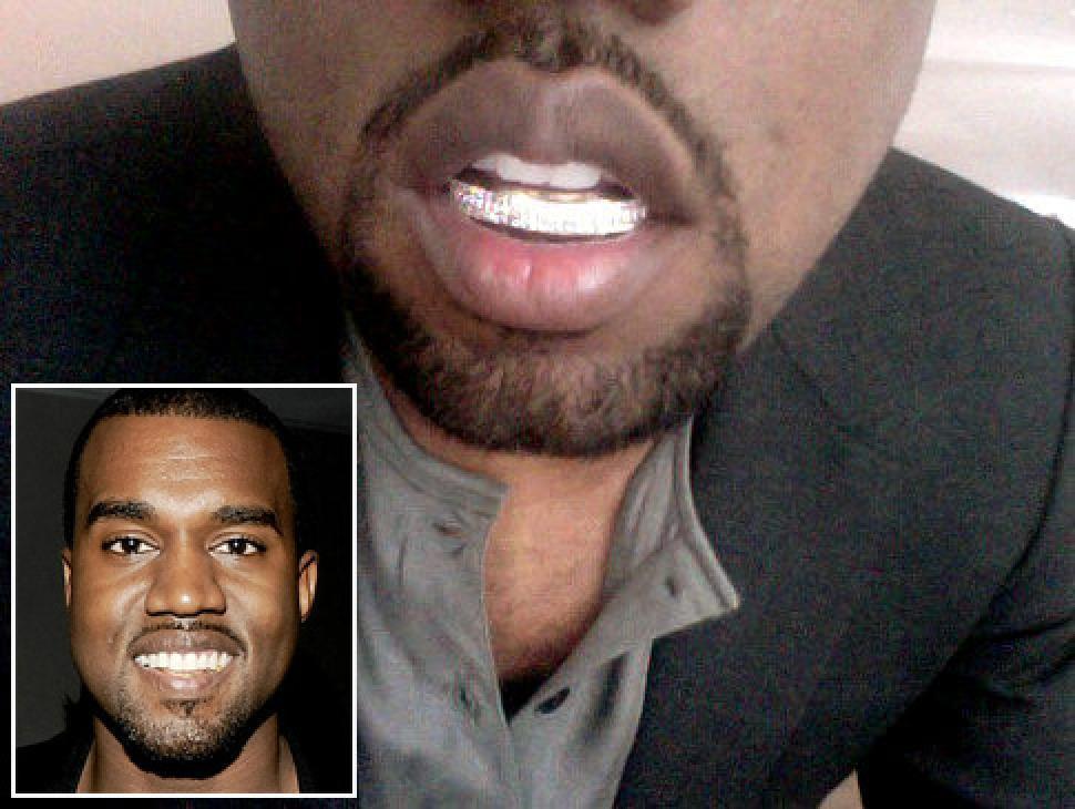 JDTK-S105-KANYE WEST'S CHOICE GRILLZ - Johnny Dang & Co