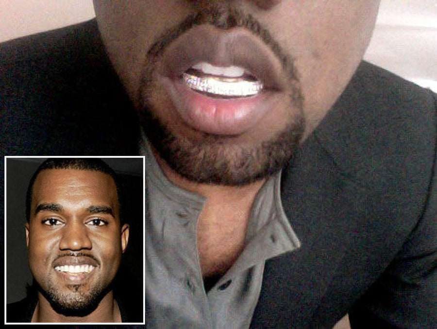 JDTK-S105-KANYE WEST'S CHOICE GRILLZ - Johnny Dang & Co