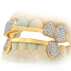 C-110 CUSTOM HAND PRONG SET DIAMOND GRILL - Johnny Dang & Co