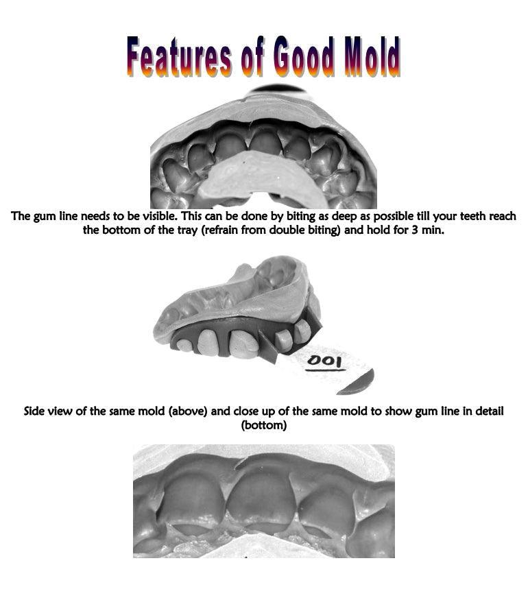 Easy DIY Dental Molding kit and Instructions-2 Kits - Johnny Dang & Co